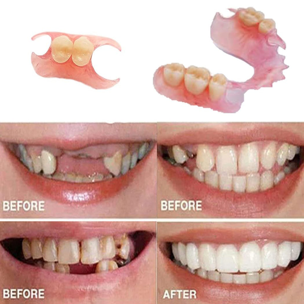 Fake Tooth Repair Kit Q105